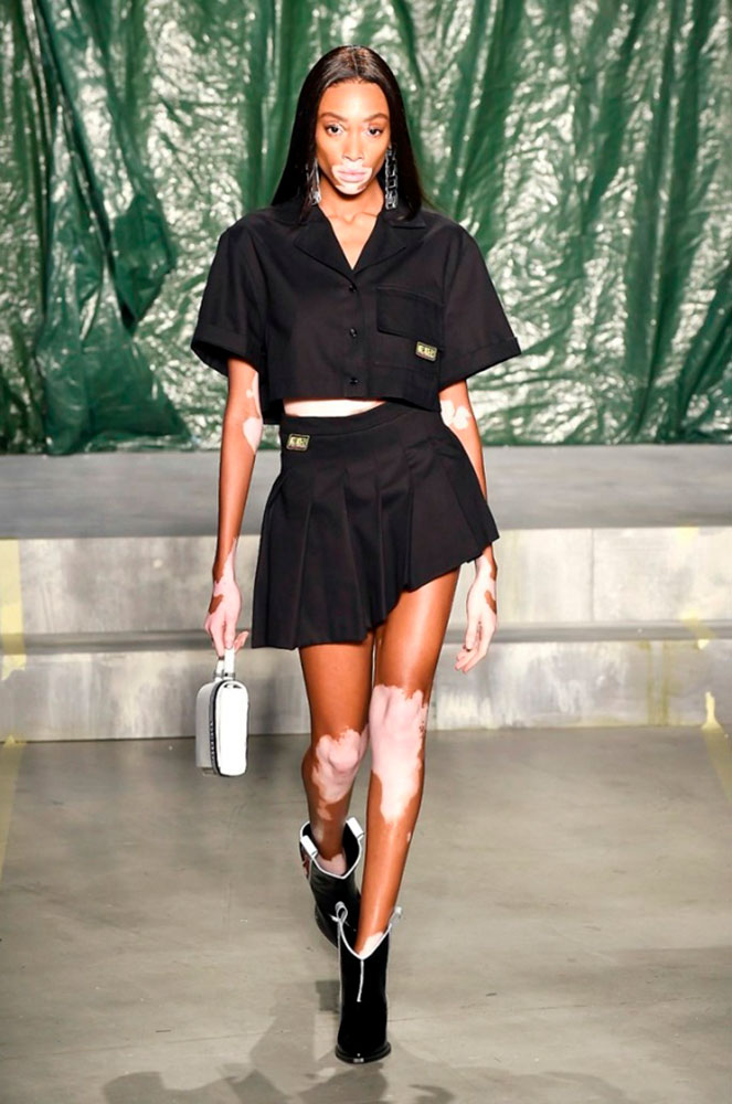 Model amb vitiligen Milan fashion week