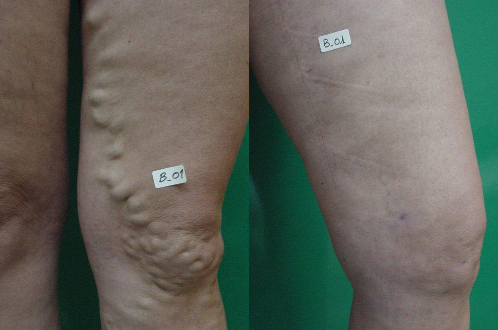 Tractament del Dr. Carlos Boné varius